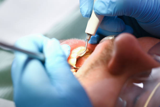 Best Broken or Cracked Tooth Emergency Dentist in Hallam, PA